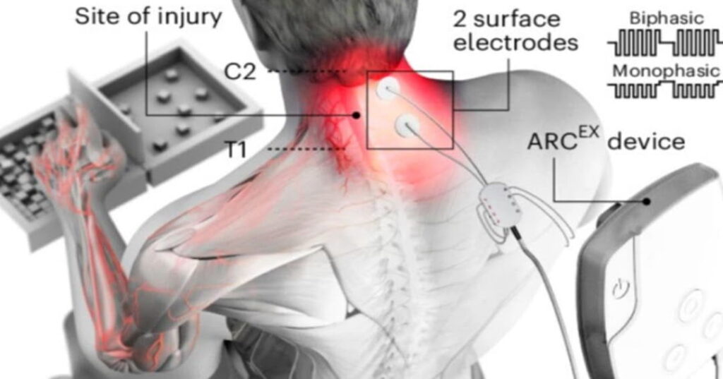 Pacientes tetrapléjicos