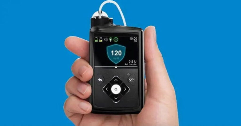 páncreas artificial