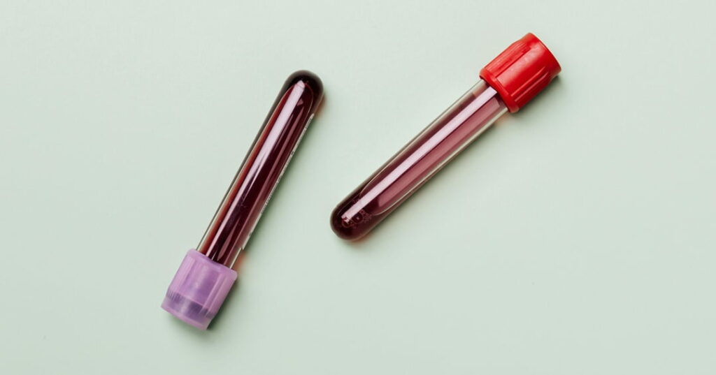 enzimas transforman sangre