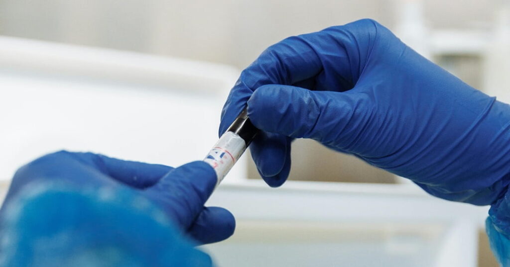 enzimas transforman sangre