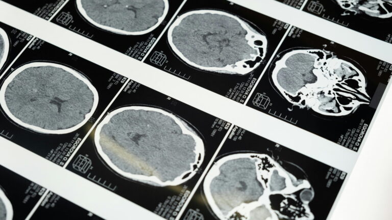LAS NEURONAS