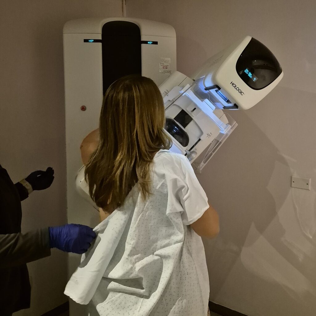 prevención del cáncer de mama