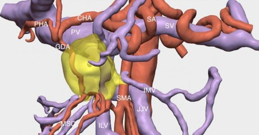 Hospital Universitario de Bellvitge