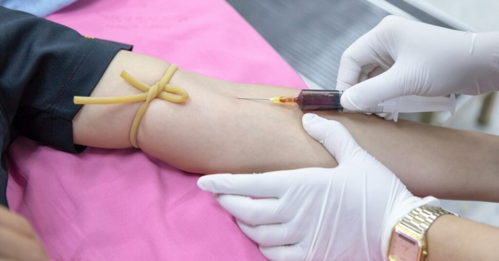 Detección de coágulos sanguíneos