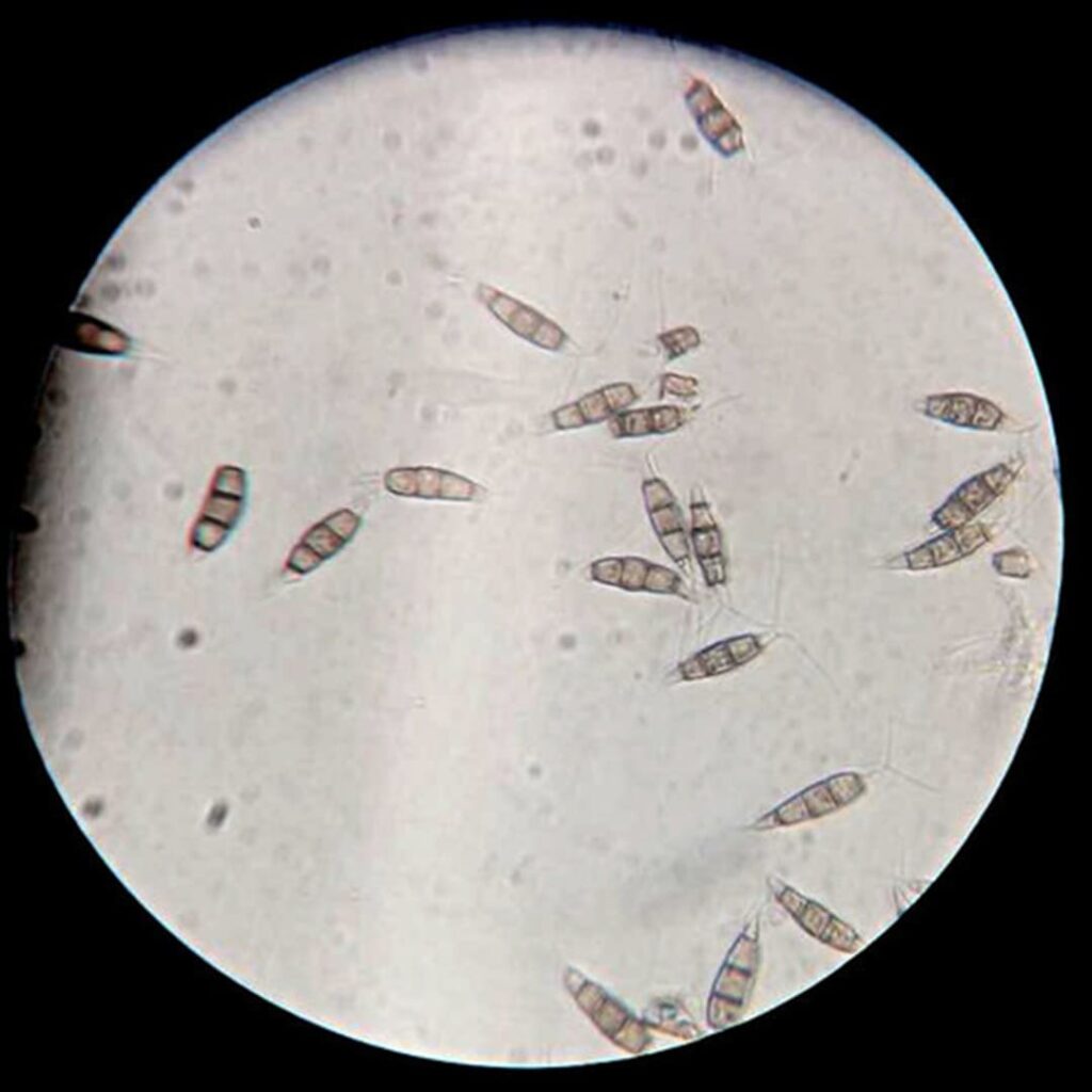 Pestalotiopsis microspora