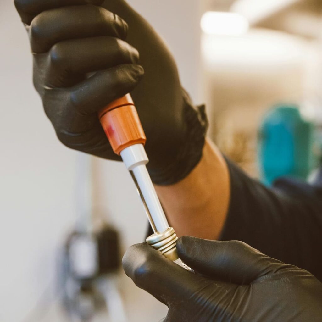 Análisis de sangre esclerosis múltiple