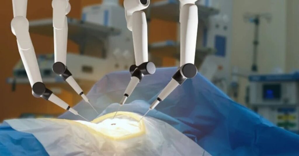Cirugía asistida con inteligencia artificial