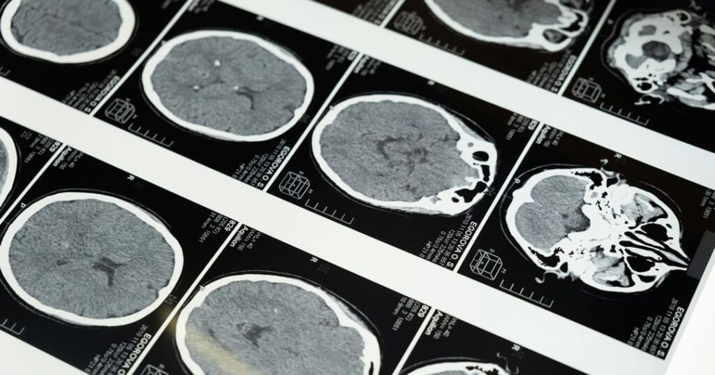 Avances en enurociencia