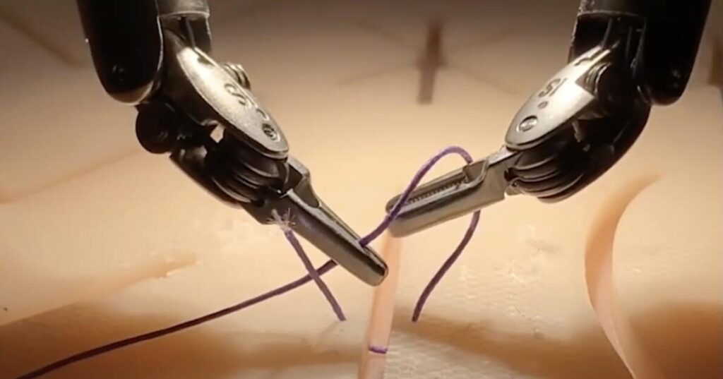 Cirugía asistida con inteligencia artificial