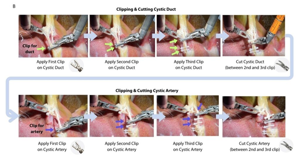 Cirugía asistida con inteligencia artificial
