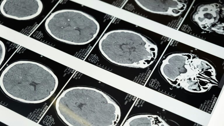 Avances en enurociencia