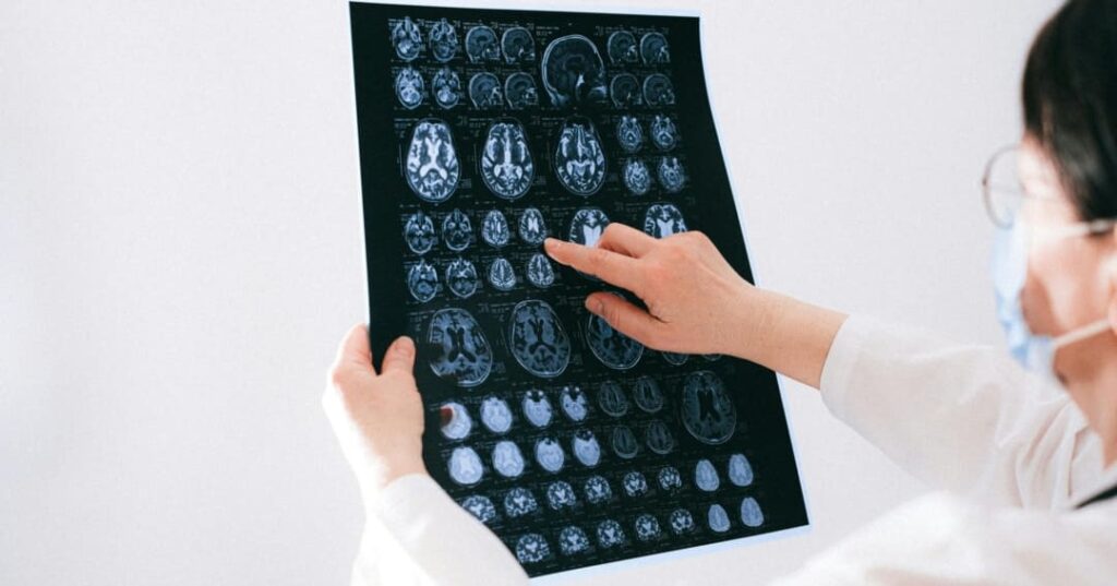 Cirugía de epilepsia Panamá