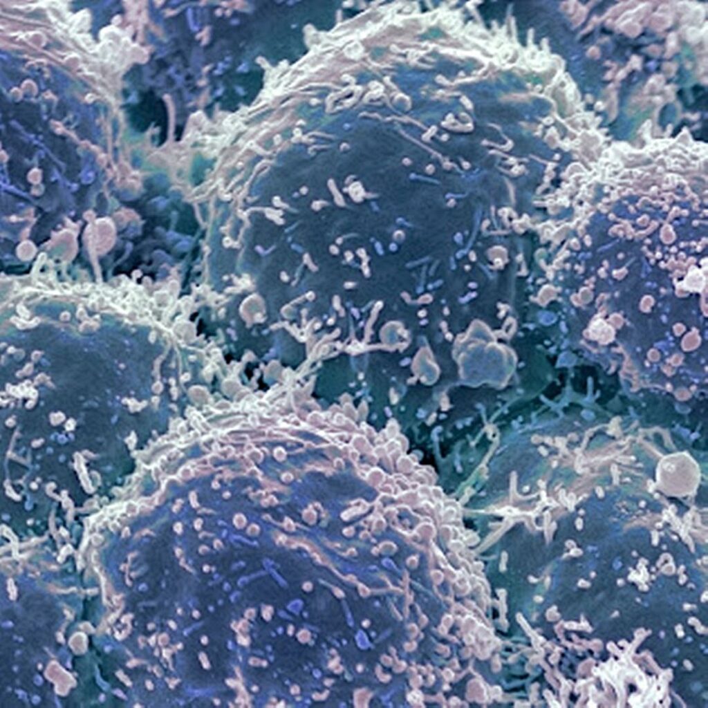 Medicina de precisión