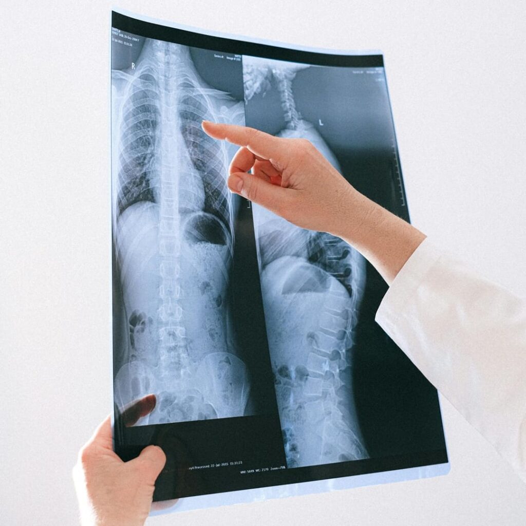 Reparación de la médula espinal