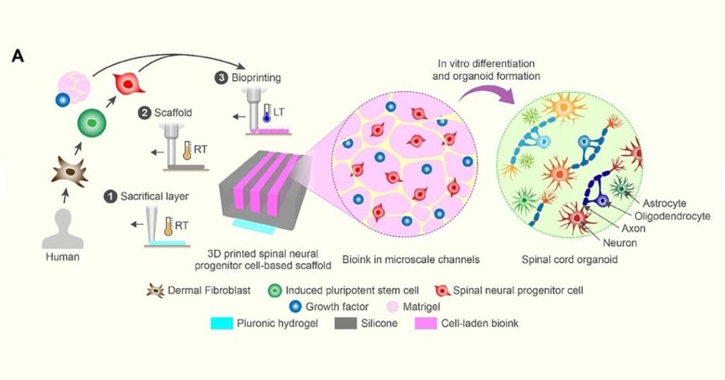 Reparación de la médula espinal