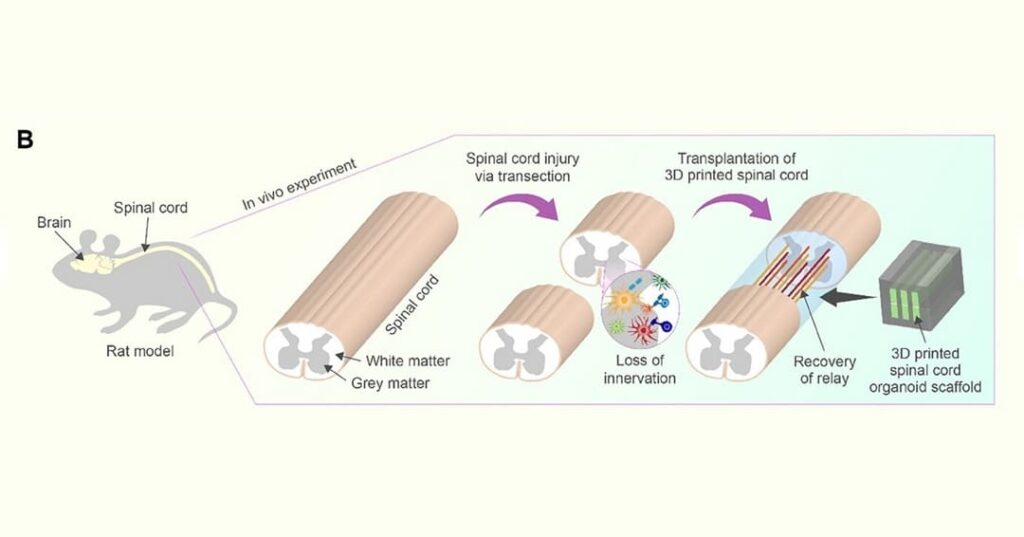 Reparación de la médula espinal