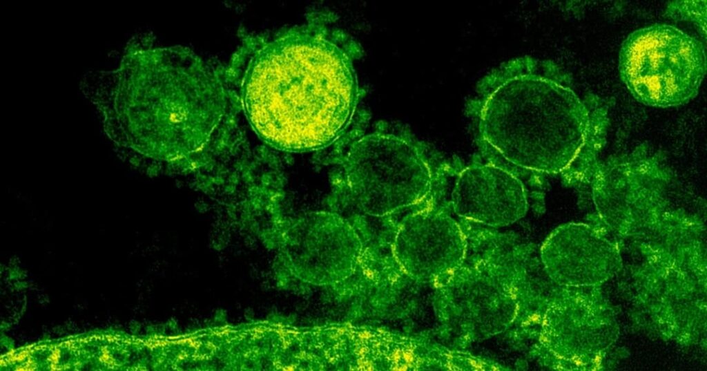 vínculo entre cerebro-intestino