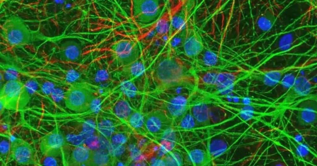 vínculo entre cerebro-intestino